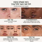 RN1 - Fair Rosy Neutral